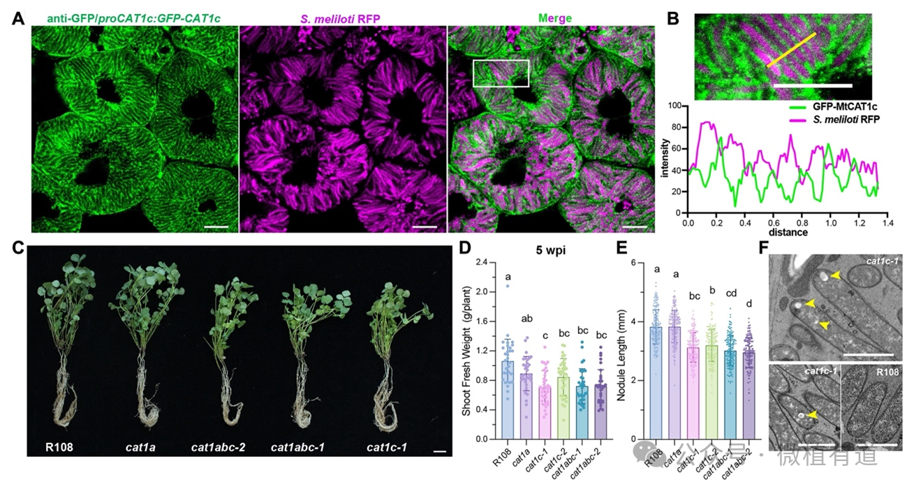 科普 | 给作物开小灶：科学家发现豆科植物与根瘤菌高效合作的新秘密